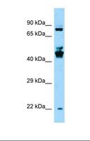 SPDYE3 Antibody - Western blot of Human OVCAR-3 . SPDYE3 antibody dilution 1.0 ug/ml.  This image was taken for the unconjugated form of this product. Other forms have not been tested.