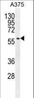 SPDYE3 Antibody - SPDYE3 Antibody western blot of A375 cell line lysates (35 ug/lane). The SPDYE3 antibody detected the SPDYE3 protein (arrow).