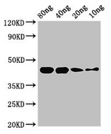 SPEB Antibody - Western Blot Positive WB detected in Recombinant protein All lanes: speB antibody at 2.8µg/ml Secondary Goat polyclonal to rabbit IgG at 1/50000 dilution Predicted band size: 44 kDa Observed band size: 44 kDa
