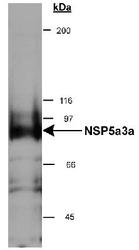 SPECC1 / CYTSB Antibody - Detection of NSP5a3a in HeLa whole cell lysate (RIPA). 0.5 ug/ml dilution, 15 second ECL detection.  This image was taken for the unconjugated form of this product. Other forms have not been tested.