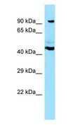 SPECC1 / CYTSB Antibody - SPECC1 / CYTSB antibody Western Blot of HepG2.  This image was taken for the unconjugated form of this product. Other forms have not been tested.