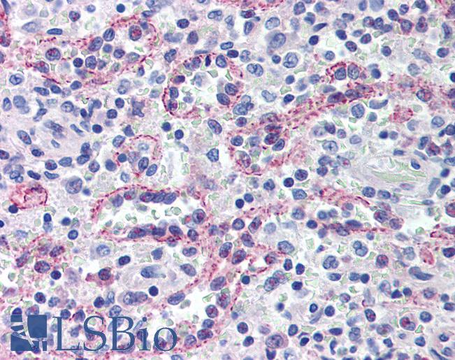 SPECC1 / CYTSB Antibody - Anti-SPECC1 / CYTSB antibody IHC of human spleen. Immunohistochemistry of formalin-fixed, paraffin-embedded tissue after heat-induced antigen retrieval. Antibody concentration 10 ug/ml.  This image was taken for the unconjugated form of this product. Other forms have not been tested.