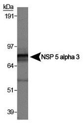 SPECC1 / CYTSB Antibody - Detection of NSP5a3a in HeLa whole cell lysate (RIPA). 0.5 ug/ml dilution, 15 second ECL detection.  This image was taken for the unconjugated form of this product. Other forms have not been tested.