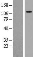 SPECC1 / CYTSB Protein - Western validation with an anti-DDK antibody * L: Control HEK293 lysate R: Over-expression lysate