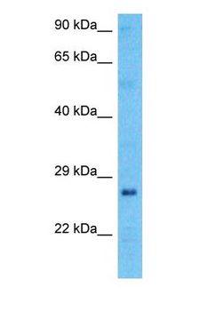 SPEF1 / C20orf28 Antibody - Western blot of SPEF1 Antibody with human Ovary Tumor lysate.  This image was taken for the unconjugated form of this product. Other forms have not been tested.