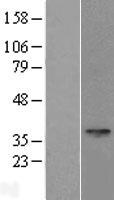 SPEM1 Protein - Western validation with an anti-DDK antibody * L: Control HEK293 lysate R: Over-expression lysate