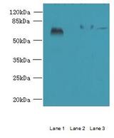 SPERT Antibody - Western blot. All lanes: SPERT antibody at 7 ug/ml. Lane 1: Rat gonadal tissue. Lane 2: Mouse lung tissue. Lane 3: A549 whole cell lysate. Secondary antibody: Goat polyclonal to Rabbit IgG at 1:10000 dilution. Predicted band size: 52 kDa. Observed band size: 52 kDa.