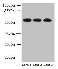 SPERT Antibody - Western blot All lanes: SPERT antibody at 7µg/ml Lane 1: Rat gonadal tissue Lane 2: Mouse lung tissue Lane 3: A549 whole cell lysate Secondary Goat polyclonal to rabbit IgG at 1/10000 dilution Predicted band size: 52, 48 kDa Observed band size: 52 kDa