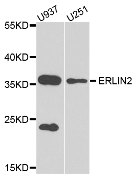 SPFH2 / ERLIN2 Antibody - Western blot analysis of extract of various cells.
