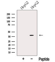 SPFH2 / ERLIN2 Antibody - Western blot analysis of extracts of HepG2 cells using ERLN2 antibody. The lane on the left was treated with blocking peptide.