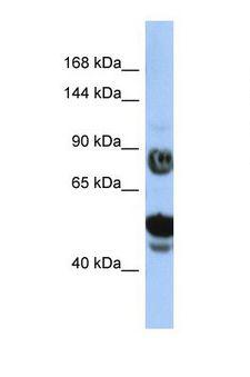 SPG15 / ZFYVE26 Antibody - Western blot of Human HepG2. ZFYVE26 antibody dilution 1.0 ug/ml.  This image was taken for the unconjugated form of this product. Other forms have not been tested.
