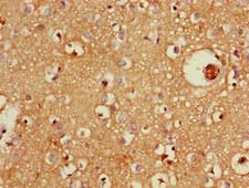 SPG15 / ZFYVE26 Antibody - Immunohistochemistry image of paraffin-embedded human brain tissue at a dilution of 1:100