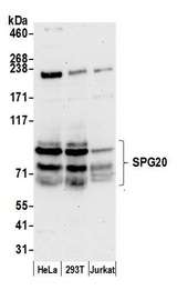 SPG20 / SPARTIN Antibody - Detection of human SPG20 by western blot. Samples: Whole cell lysate (50 µg) from HeLa, HEK293T, and Jurkat cells prepared using NETN lysis buffer. Antibody: Affinity purified rabbit anti-SPG20 antibody used for WB at 0.1 µg/ml. Detection: Chemiluminescence with an exposure time of 30 seconds.
