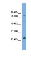 SPG20 / SPARTIN Antibody - SPG20 antibody Western blot of OVCAR-3 cell lysate. This image was taken for the unconjugated form of this product. Other forms have not been tested.