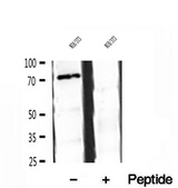 SPG20 / SPARTIN Antibody - Western blot analysis of extracts of NIH-3T3 cells using Spartin, SPG20 antibody.