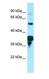 SPG21 / MAST Antibody - SPG21 / MAST antibody Western Blot of HepG2.  This image was taken for the unconjugated form of this product. Other forms have not been tested.