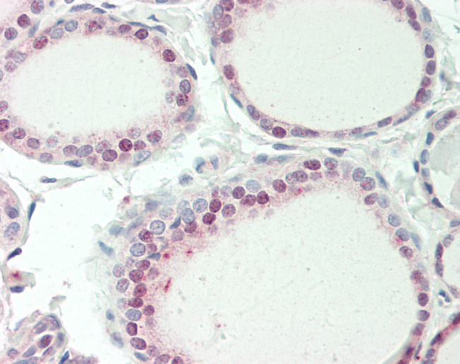 SPG21 / MAST Antibody - Human Thyroid: Formalin-Fixed, Paraffin-Embedded (FFPE).  This image was taken for the unconjugated form of this product. Other forms have not been tested.