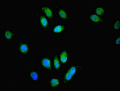 SPG21 / MAST Antibody - Immunofluorescent analysis of A549 cells using SPG21 Antibody at dilution of 1:100 and Alexa Fluor 488-congugated AffiniPure Goat Anti-Rabbit IgG(H+L)