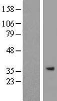 SPG21 / MAST Protein - Western validation with an anti-DDK antibody * L: Control HEK293 lysate R: Over-expression lysate