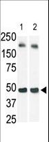 SPHK / SPHK1 Antibody - The anti-SphK1 antibody is used in Western blot (Lane 2) to detect c-myc-tagged SphK1 in transfected 293 cell lysate (a c-myc antibody is used as control in Lane 1). Data is kindly provided by Dr. J. Van Brocklyn from the Ohio State University (Columbus, OH).