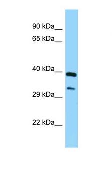 SPHK / SPHK1 Antibody - SPHK1 antibody Western blot of Fetal Lung lysate. Antibody concentration 1 ug/ml.  This image was taken for the unconjugated form of this product. Other forms have not been tested.