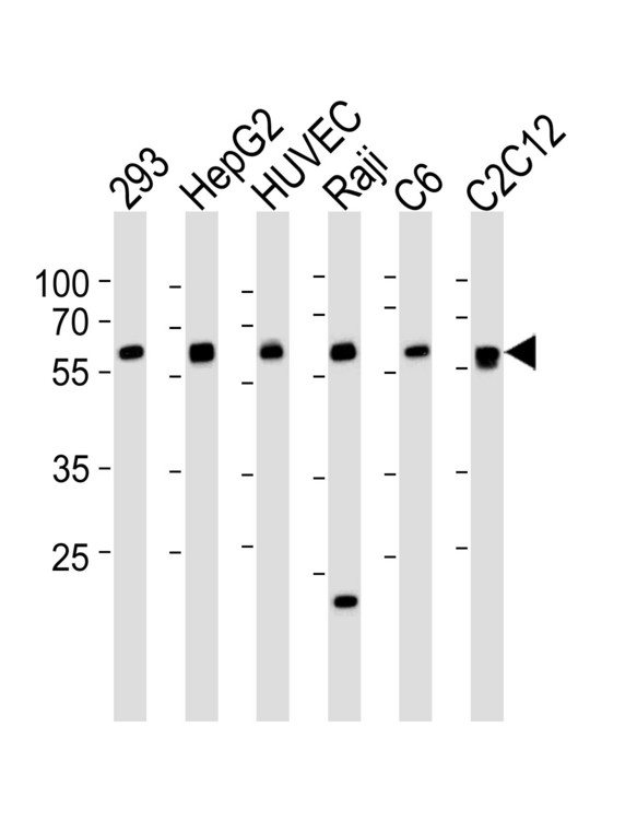 SPHK / SPHK1 Antibody - Western blot of lysates from 293, HepG2, HUVEC, Raji, rat C6, mouse C2C12 cell line (from left to right), using SPHK1 Antibody (R301). Antibody was diluted at 1:1000 at each lane. A goat anti-rabbit IgG H&L (HRP) at 1:5000 dilution was used as the secondary antibody. Lysates at 35ug per lane.