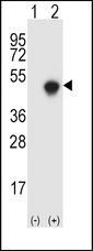 SPHK / SPHK1 Antibody - Western blot of SPHK1 (arrow) using rabbit polyclonal SPHK1 Antibody (R301). 293 cell lysates (2 ug/lane) either nontransfected (Lane 1) or transiently transfected (Lane 2) with the SPHK1 gene.