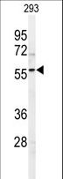 SPHK / SPHK1 Antibody - Western blot of SPHK1 Antibody (C-term R414) in 293 cell line lysates (35 ug/lane). SPHK1 (arrow) was detected using the purified antibody.