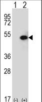SPHK / SPHK1 Antibody - Western blot of SPHK1 (arrow) using rabbit polyclonal SPHK1 Antibody (C-term R414). 293 cell lysates (2 ug/lane) either nontransfected (Lane 1) or transiently transfected (Lane 2) with the SPHK1 gene.