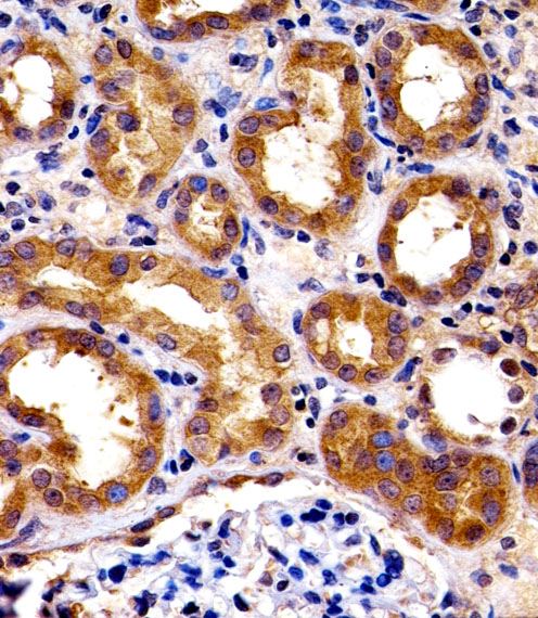 SPHK / SPHK1 Antibody - Immunohistochemical of paraffin-embedded H. kidney section using SPHK1 Antibody(N-term P74). Antibody was diluted at 1:100 dilution. A peroxidase-conjugated goat anti-rabbit IgG at 1:400 dilution was used as the secondary antibody, followed by DAB staining.