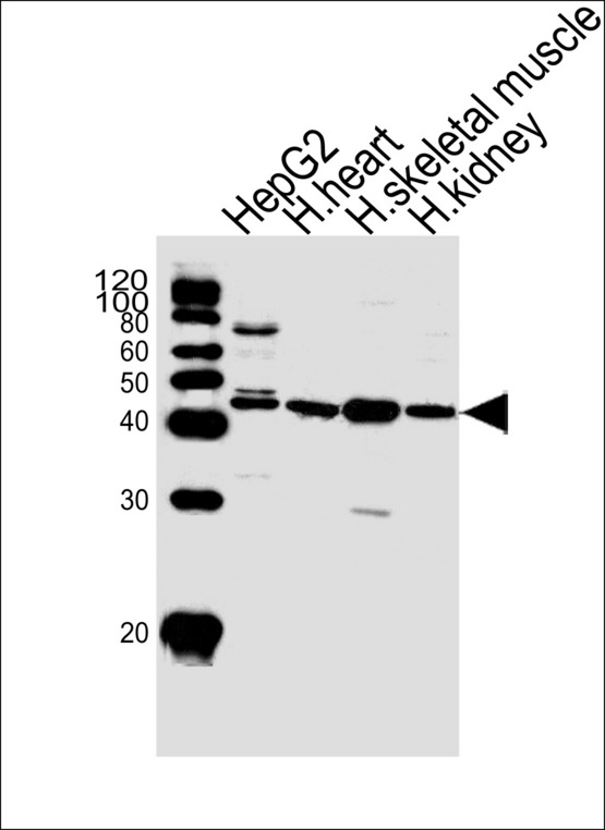 SPHK / SPHK1 Antibody - Western blot of lysates from HepG2 cell line and human heart, skeletal muscle, kidney tissue lysate(from left to right), using SPHK1 Antibody (N-term P74). Antibody was diluted at 1:1000 at each lane. A goat anti-rabbit IgG H&L (HRP) at 1:5000 dilution was used as the secondary antibody. Lysates at 35ug per lane.