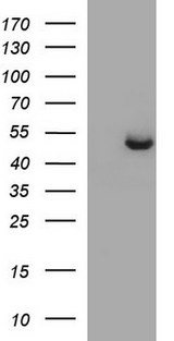 SPHK / SPHK1 Antibody - HEK293T cells were transfected with the pCMV6-ENTRY control (Left lane) or pCMV6-ENTRY SPHK1 (Right lane) cDNA for 48 hrs and lysed. Equivalent amounts of cell lysates (5 ug per lane) were separated by SDS-PAGE and immunoblotted with anti-SPHK1.