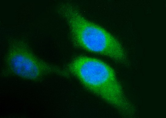 SPHK / SPHK1 Antibody - Immunofluorescent staining of HeLa cells using anti-SPHK1 mouse monoclonal antibody.