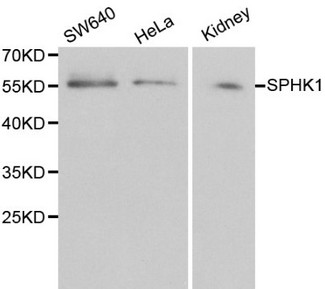 SPHK / SPHK1 Antibody - Western blot of SPHK1 pAb in extracts from SW640, Hela cells and mouse kidney tissue.