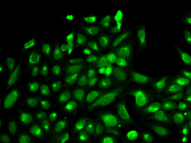 SPHK / SPHK1 Antibody - Immunofluorescence analysis of HeLa cells.
