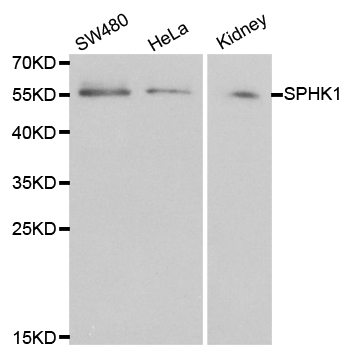 SPHK / SPHK1 Antibody - Western blot analysis of extracts of various cell lines, using SPHK1 antibody at 1:1000 dilution. The secondary antibody used was an HRP Goat Anti-Rabbit IgG (H+L) at 1:10000 dilution. Lysates were loaded 25ug per lane and 3% nonfat dry milk in TBST was used for blocking.