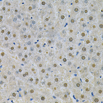 SPHK / SPHK1 Antibody - Immunohistochemistry of paraffin-embedded rat liver using SPHK1 Antibodyat dilution of 1:200 (40x lens).