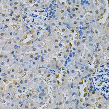 SPHK / SPHK1 Antibody - Immunohistochemistry of paraffin-embedded rat kidney using SPHK1 Antibodyat dilution of 1:200 (40x lens).