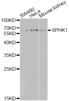SPHK / SPHK1 Antibody - Western blot analysis of extracts of various cell lines, using SPHK1 antibody at 1:1000 dilution. The secondary antibody used was an HRP Goat Anti-Rabbit IgG (H+L) at 1:10000 dilution. Lysates were loaded 25ug per lane and 3% nonfat dry milk in TBST was used for blocking.