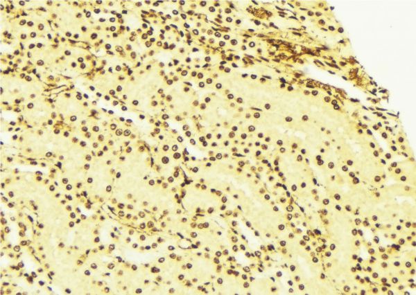 SPHK / SPHK1 Antibody - 1:100 staining mouse liver tissue by IHC-P. The sample was formaldehyde fixed and a heat mediated antigen retrieval step in citrate buffer was performed. The sample was then blocked and incubated with the antibody for 1.5 hours at 22°C. An HRP conjugated goat anti-rabbit antibody was used as the secondary.