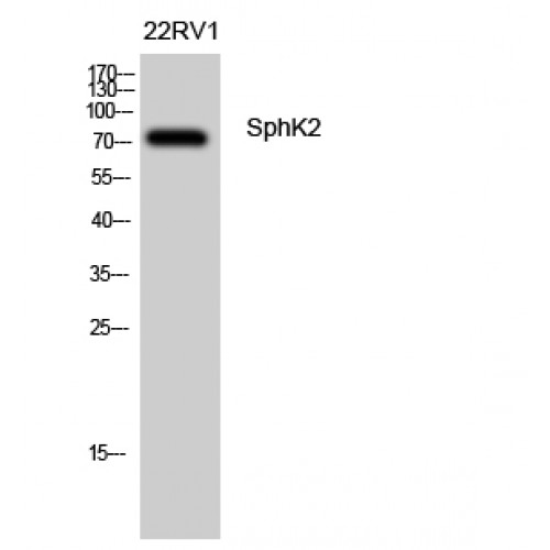SPHK2 Antibody - Western blot of SphK2 antibody