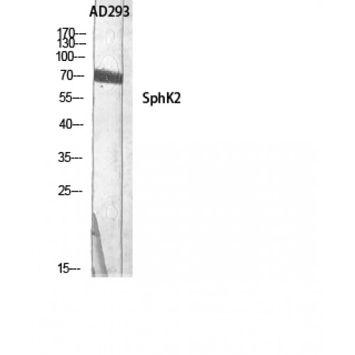 SPHK2 Antibody - Western blot of SphK2 antibody
