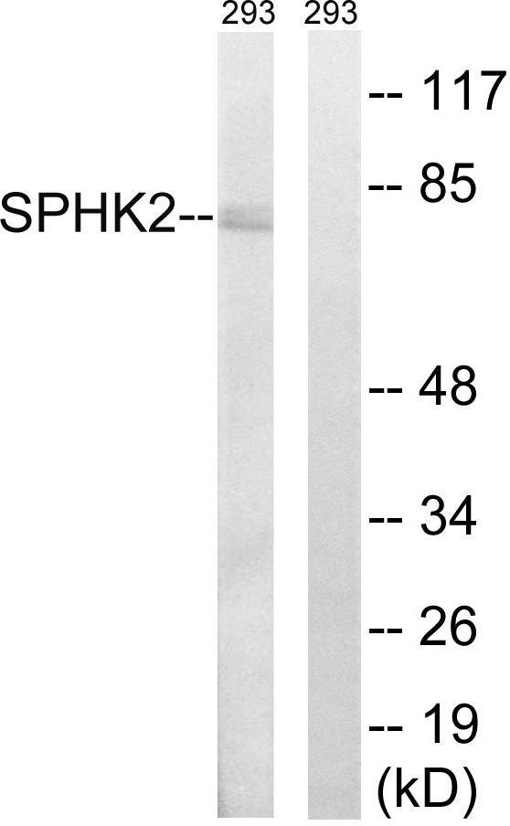 SPHK2 Antibody - Western blot analysis of lysates from 293 cells, using SPHK2 Antibody. The lane on the right is blocked with the synthesized peptide.