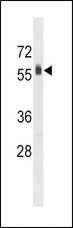 SPHK2 Antibody - SPHK2 Antibody (A605) western blot of HepG2 cell line lysates (35 ug/lane). The SPHK2 antibody detected the SPHK2 protein (arrow).