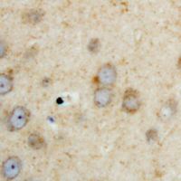 SPHK2 Antibody - Immunohistochemical analysis of SPHK2 staining in human brain formalin fixed paraffin embedded tissue section. The section was pre-treated using heat mediated antigen retrieval with sodium citrate buffer (pH 6.0). The section was then incubated with the antibody at room temperature and detected with HRP and DAB as chromogen. The section was then counterstained with hematoxylin and mounted with DPX.