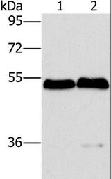 SPHK2 Antibody - Western blot analysis of Mouse brain and liver tissue, using SPHK2 Polyclonal Antibody at dilution of 1:200.
