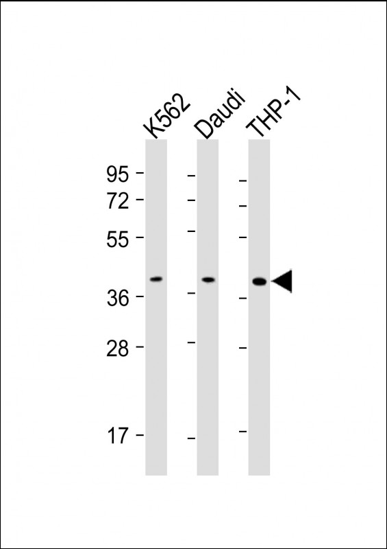SPI1 / PU.1 Antibody - All lanes: Anti-SPI1 Antibody at 1:500-1:1000 dilution Lane 1: K562 whole cell lysate Lane 2: Daudi whole cell lysate Lane 3: THP-1 whole cell lysate Lysates/proteins at 20 µg per lane. Secondary Goat Anti-mouse IgG, (H+L), Peroxidase conjugated at 1/10000 dilution. Predicted band size: 31 kDa Blocking/Dilution buffer: 5% NFDM/TBST.