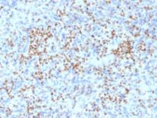 SPI1 / PU.1 Antibody - IHC staining of FFPE human spleen with SOX9 antibody (clone PU1/2146). HIER: boil tissue sections in pH6, 10mM citrate buffer, for 10-20 min followed by cooling at RT for 20 min.