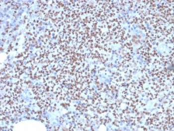 SPI1 / PU.1 Antibody - IHC staining of FFPE human lymph node with SOX9 antibody (clone PU1/2146). HIER: boil tissue sections in pH6, 10mM citrate buffer, for 10-20 min followed by cooling at RT for 20 min.