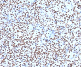 SPI1 / PU.1 Antibody - IHC staining of FFPE human lymph node with SOX9 antibody (clone TFPU1-1). HIER: boil tissue sections in pH6, 10mM citrate buffer, for 10-20 min followed by cooling at RT for 20 min.
